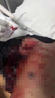 Detik-Detik Penikaman Empat Brimob di Labuan Bajo, Pelaku Diduga Kabur ke Permukiman Warga