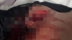 Detik-Detik Penikaman Empat Brimob di Labuan Bajo, Pelaku Diduga Kabur ke Permukiman Warga
