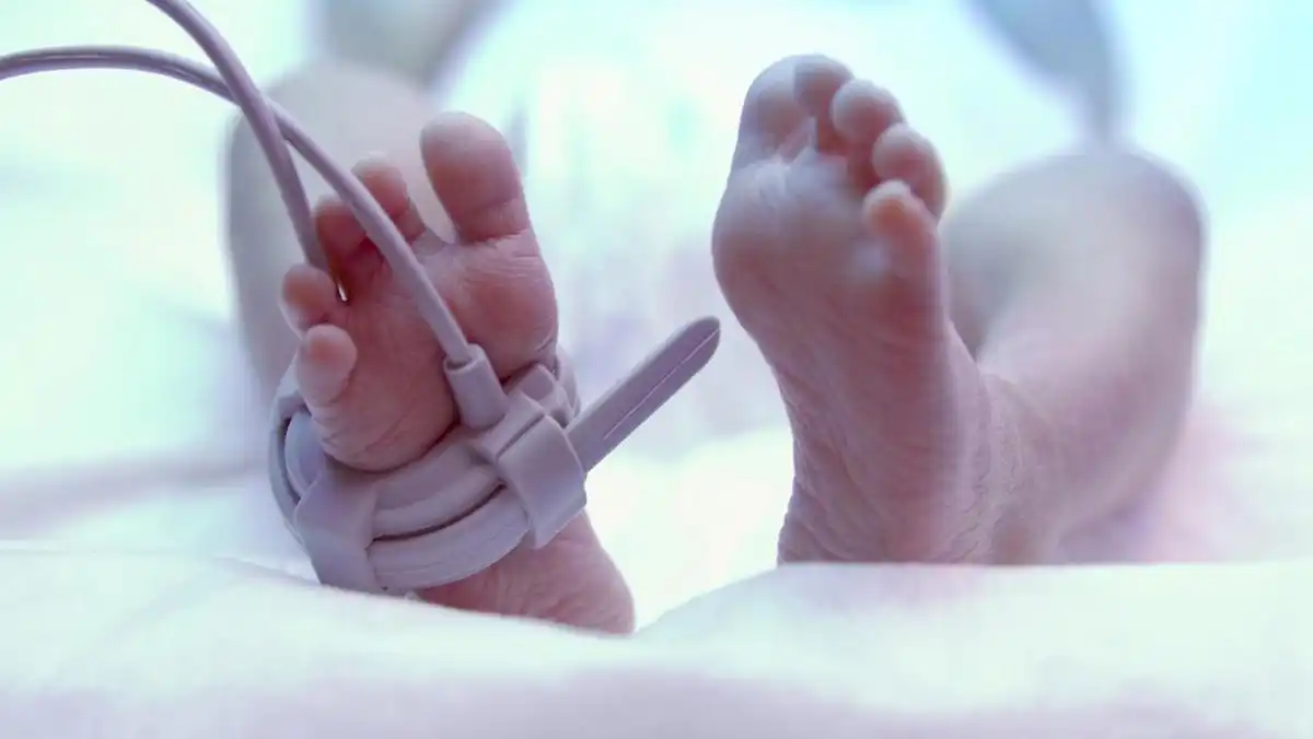 Bayi 24 Hari di Surabaya Meninggal Usai Diberi Telur Mentah, Ini Penjelasan soal MPASI